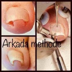 Foto van de ARKADA Methode